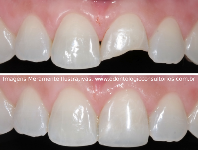 Dentística Restauradora