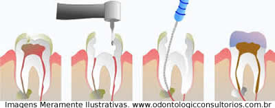 Endodontia