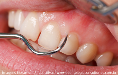 Periodontia