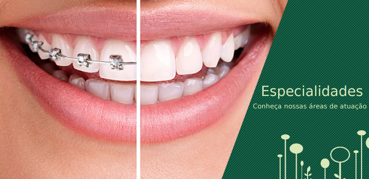 Conhea nossas especialidades